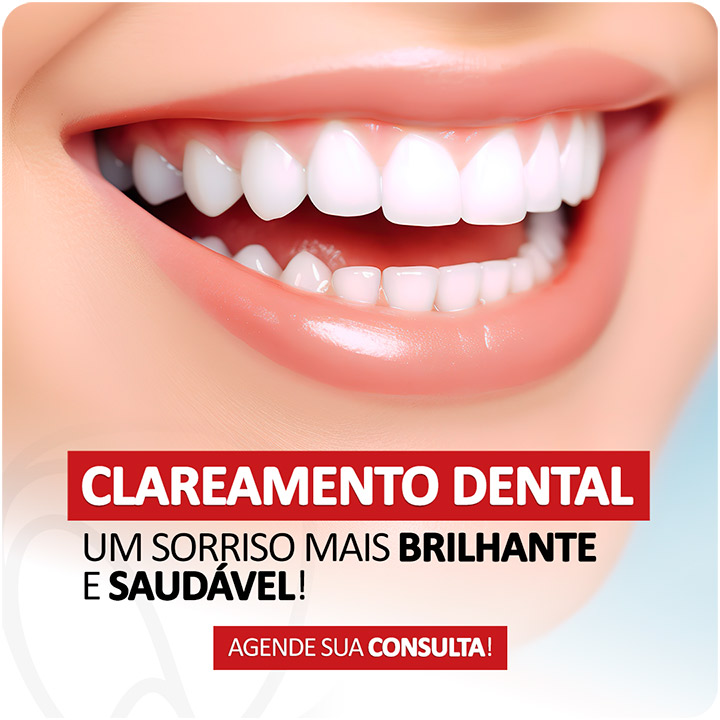 Clareamento Dental: Um Sorriso Mais Brilhante e Saudável - Quais são os tipo e quando é indicado?