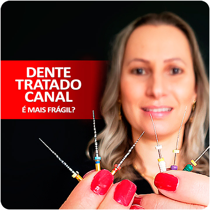 Um Dente que já foi tratado o canal fica mais frágil? - Tratamento Endodôntico