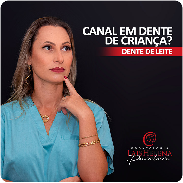 Faz Canal em Dente de Criança? - Afinal Dente de Leite precisa de Tratamento de Canal?